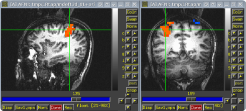 Some creepy brain photos